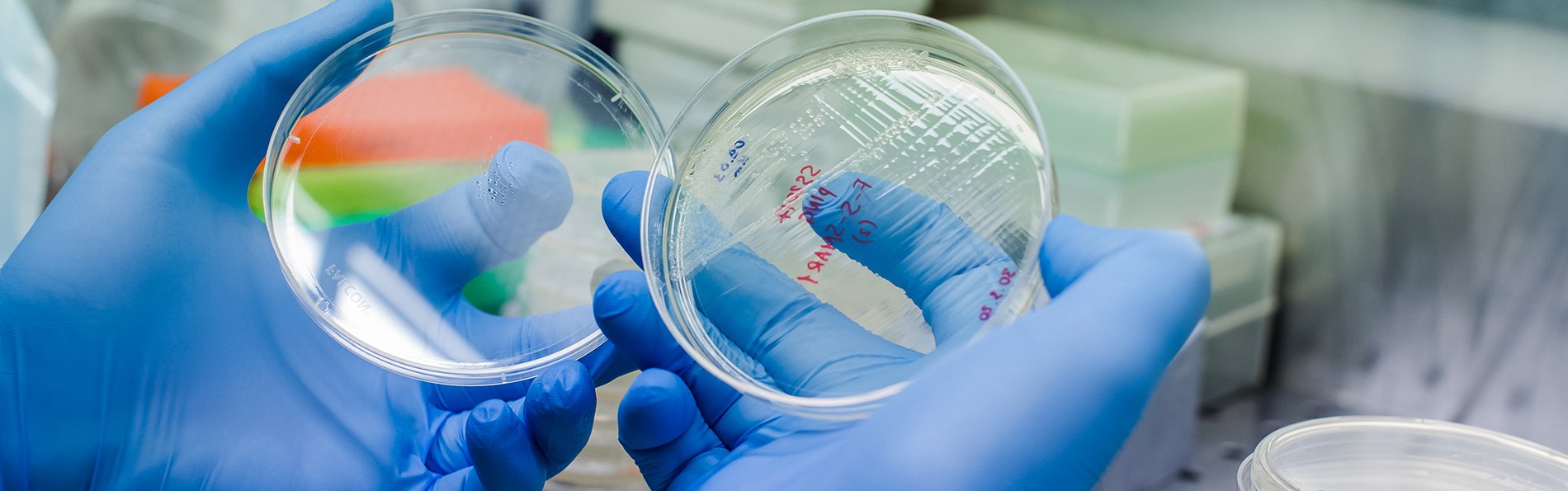 MS, macular degeneration and nanoparticle researchers win Gates grants