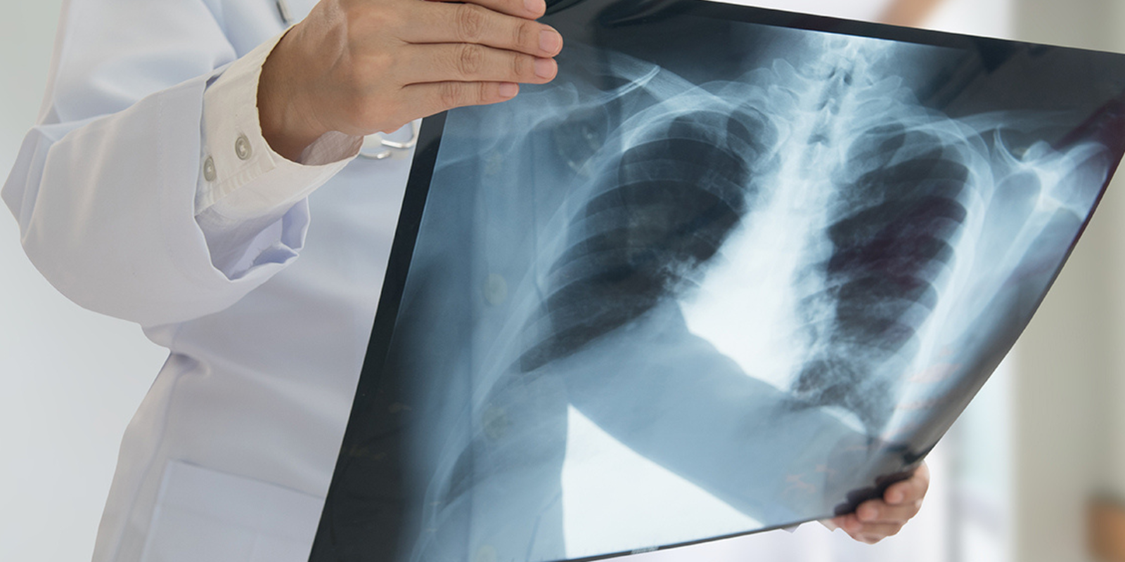 A doctor holds an x-ray scan. 